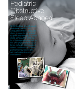 Pediatric Obstructive Sleep Apnoea