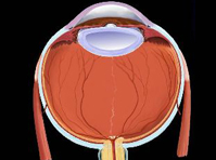 Retinopathy of prematurity